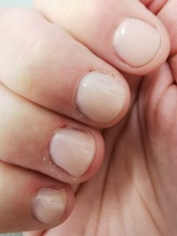 Links Tips zur Nagelpflege bei sehr kurzen Nägeln in Gelnägel