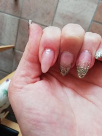 Fiberglas Nagel mit Nagelhautverletzung Wie feilen ohne Nagelhaut zu verletzen? in Tipps / Tricks