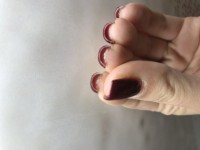 Linke Hand Trockene Haut unter den Nägeln in Maniküre