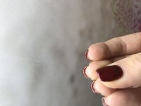 Rechte Hand Trockene Haut unter den Nägeln in Maniküre