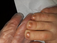 mittige Zehen rechts Ratlos - kosmetische Fußpflege in Pediküre