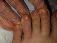 linker Fuß Ratlos - kosmetische Fußpflege in Pediküre