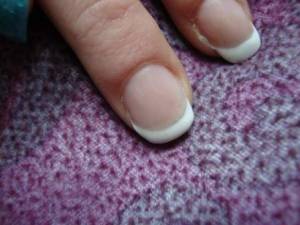 breiter Nagel Breites Nagelbett, wie dünner aussehen lassen? in Nägel kauen