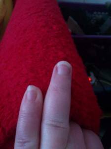 Ringfinger Abschälung leicht mittig Gel vs. Acryl bei unebenen Nägeln mit Rillen?! in Gelnägel