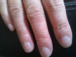 meine kleinen finger Nageltip grössenproblem in Gelnägel