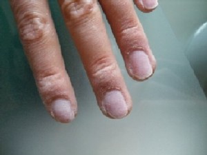 Naturnägel Vorbereiten Modellage, Kritik und Verbesserungsvorschläge! in Anfänger Nageldesign