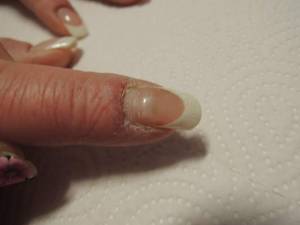  Nail Protector.nie wieder Problemnägel! in Zubehör