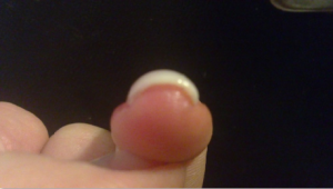 wirkt durch den Winkel etwas dicker als es eigentlich ist Nagelmodellage am eigenen Nagel~ Anfänger ;) in Anfänger Nageldesign
