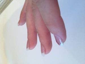 Ansicht Seitlich rechte Hand Erste Acryl Modellage auf beiden Händen in Anfänger Nageldesign