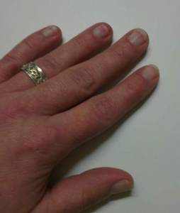 linke Hand Ruinierte Nägel - wie lackieren oder besser nicht? in Nagellack / UV