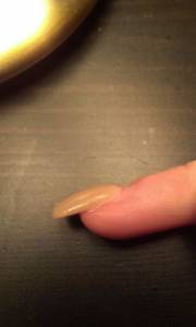 Weißer Fleck auf dem Nagel? in Nagelkrankheiten