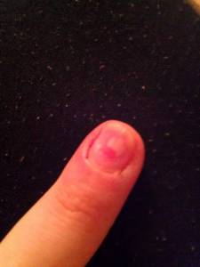 Was ist der weise fleck? Hilfe was ist das für ein fleck auf meinem nagel? in Gelnägel