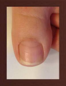 Abgelöst und kurz mit nagelöl drüber gewischt UV Lacke von Eubecos? in Nagellack / UV