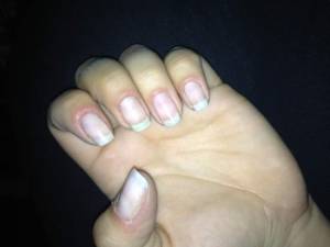 Draufsicht Vom Nagelbeisser zu schönen Nägeln! (Bericht) in Nägel kauen