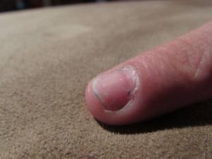 Nagel Draufsicht Huckl auf nagel in Maniküre
