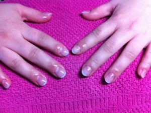 nachher2 Nagelbeisermodellage in Anfänger Nageldesign