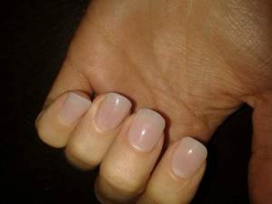 Fingernägel mit unregelmäßigem Nagelwall (ohne Markierung) Unregelmäßiger Nagelwall/-falz in Maniküre