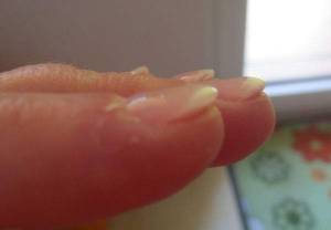 linke Hand - Seitenansicht neue Nagelmodellage - so enttäuscht in Gelnägel