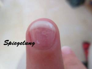 Ringfinger Neue Nagelmodellage - so enttäuscht in Gelnägel