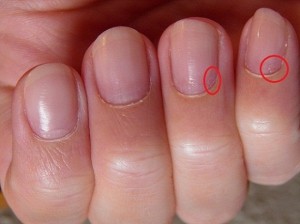 nach dem Entfernen mit Porpusher Unsichtbare Nagelhaut entfernen - Eponychium in Tipps / Tricks