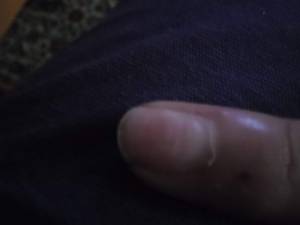 Mein kaputter nagel Asiaacryl ablösen dauert lange in Acrylnägel