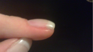 wfew.png Nagelmodellage am eigenen Nagel~ Anfänger ;) in Anfänger Nageldesign