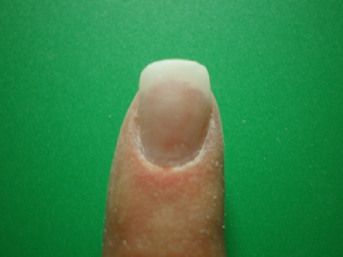 hier sieht man den kleinen Hubbel der aber eigentlich garnicht vorhanden ist Aufbau am kleinen Finger geübt in Anfänger Nageldesign