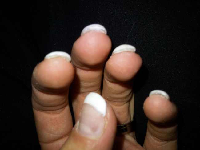 vorn Rettungsversuch der 1. Modellage - bitte Kritik :) in Anfänger Nageldesign